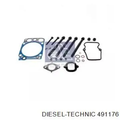 A5410101621 Mercedes Комплект прокладок двигуна, верхній