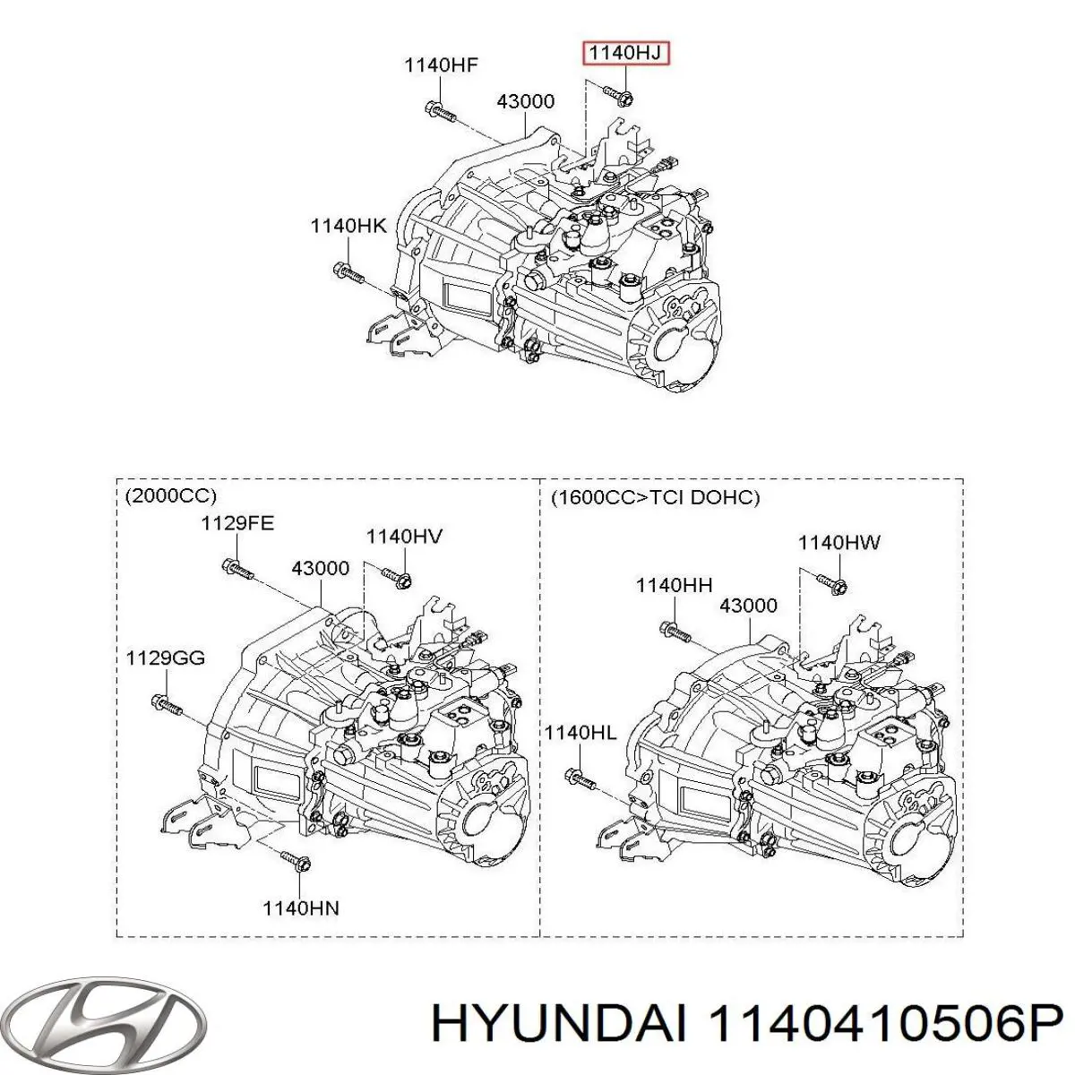 Купити 1140410503 Hyundai/Kia 