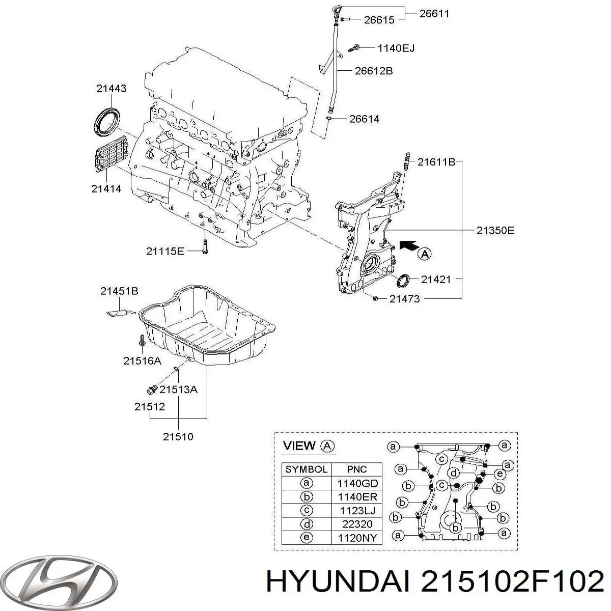215102F102 Hyundai/Kia Піддон масляний картера двигуна, верхня частина
