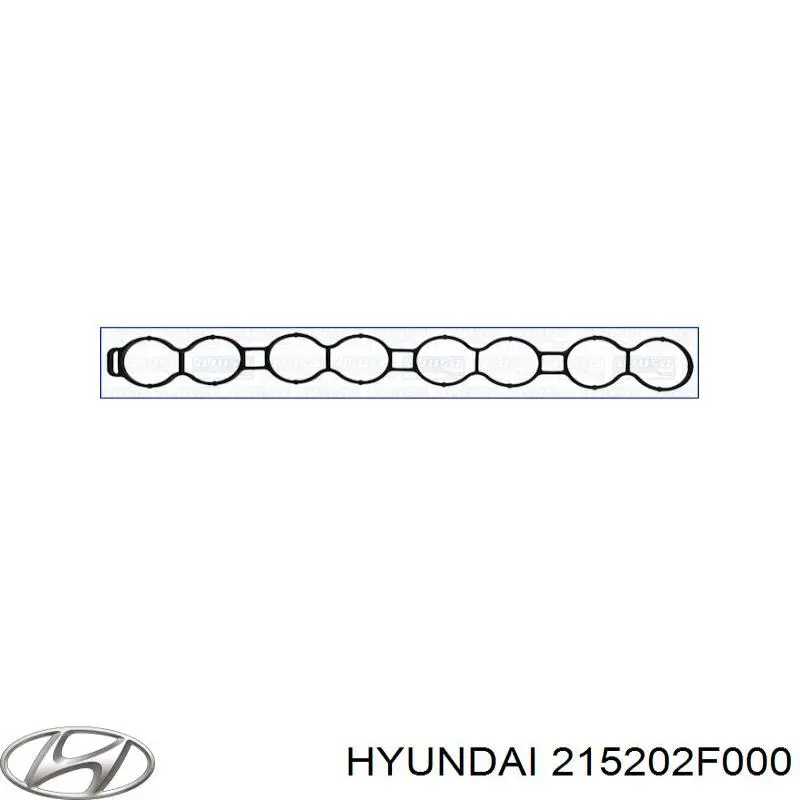 Піддон масляний картера двигуна, нижня частина 215202F000 Hyundai/Kia