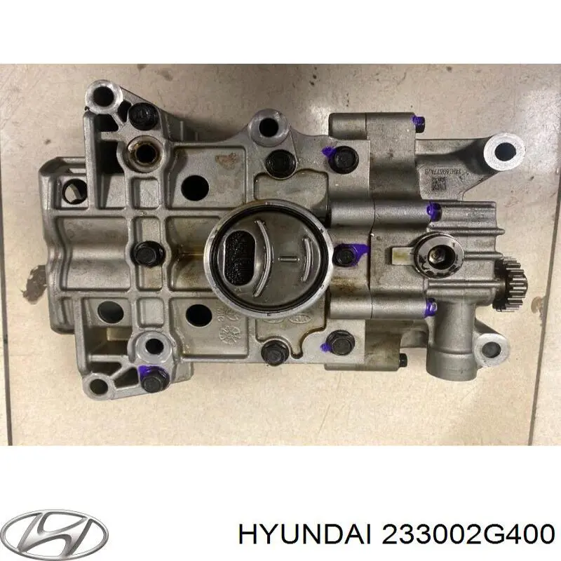Корпус балансувального механізму Hyundai Sonata (LF) (Хендай Соната)
