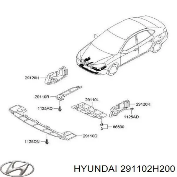 Захист ДВС Hyundai/Kia 291102H200 ціна, від 19.48 USD