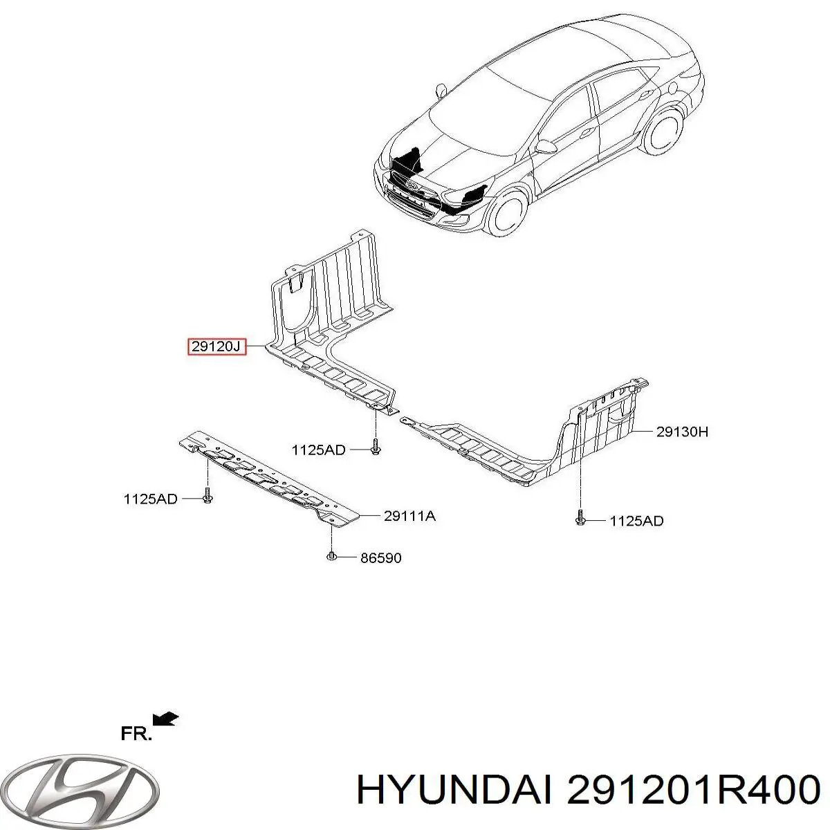 291201R400 Hyundai/Kia захист двигуна, правий