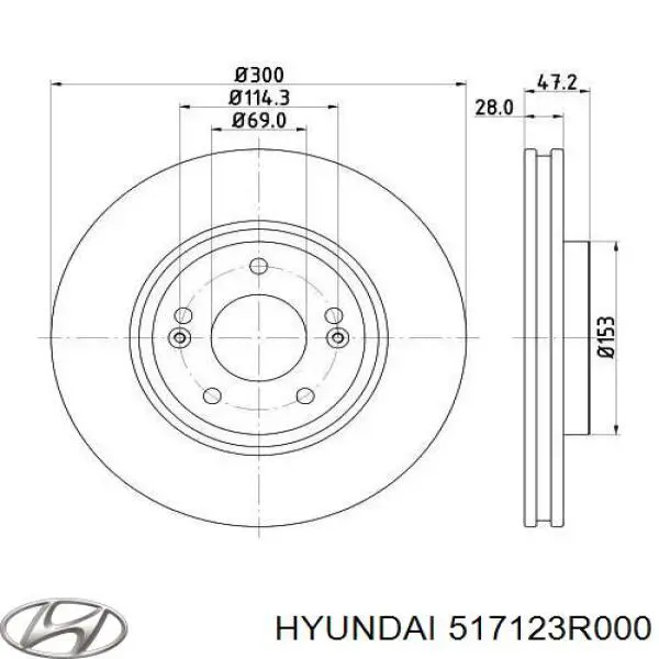  517123R000 Hyundai/Kia