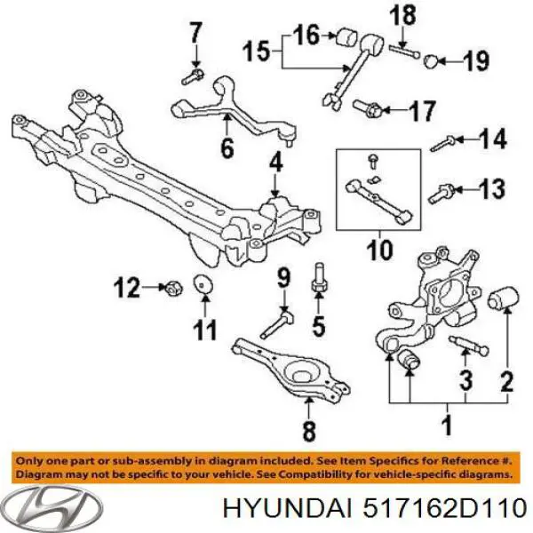 Цапфа - поворотний кулак передній, правий Hyundai Elantra (Хендай Елантра)