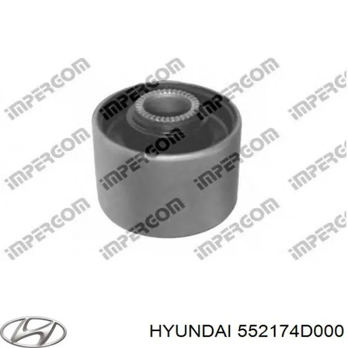 Сайлентблок заднього нижнього важеля 552174D000 Hyundai/Kia