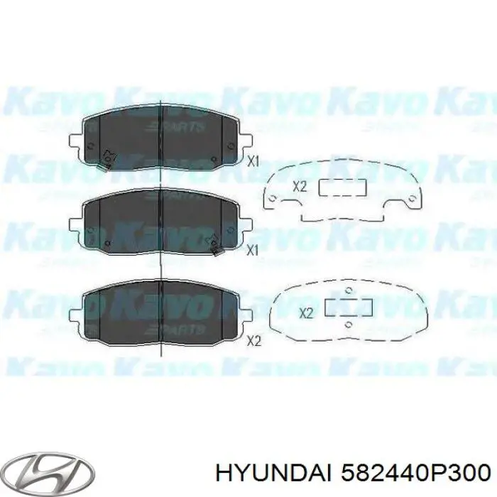  PFK651 TRW