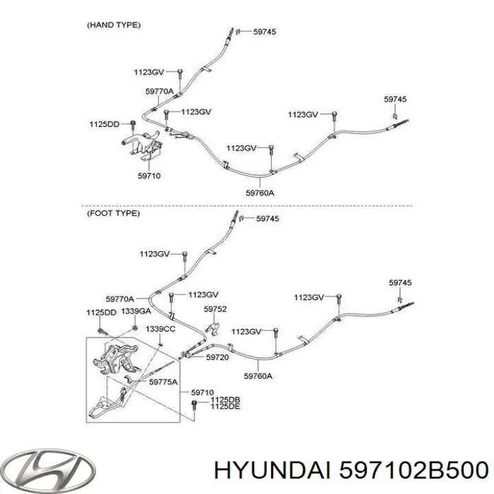 Важіль ручного гальма 597102B500 Hyundai/Kia