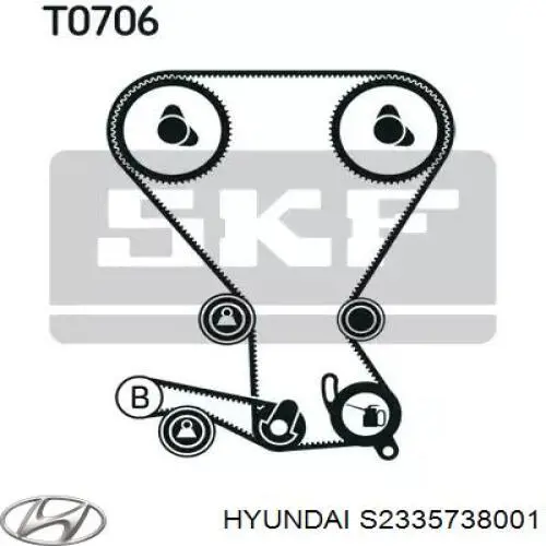 Купити S2335738001 Hyundai/Kia Ролик натягувача балансировочного ременя