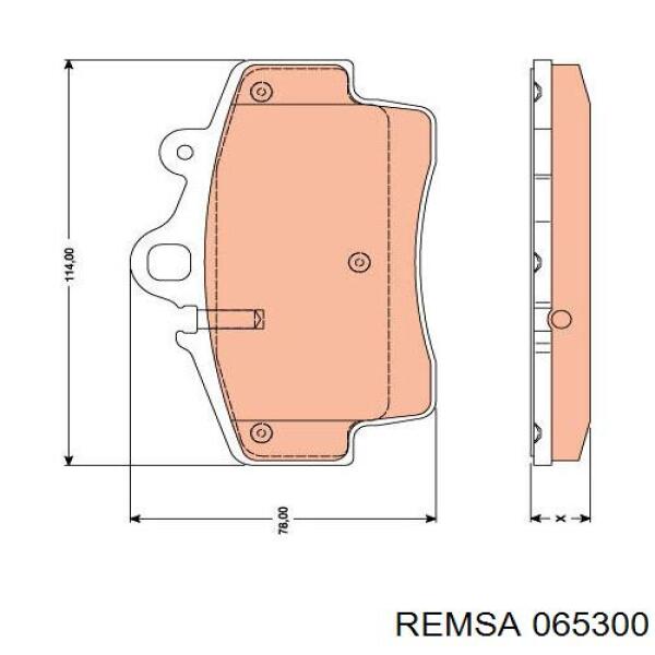 Купити 065300 Remsa Колодки гальмівні передні, дискові