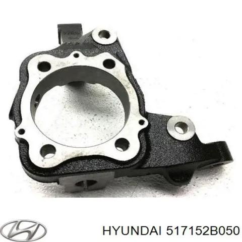 Цапфа передня ліва 517152B050 HYUNDAI