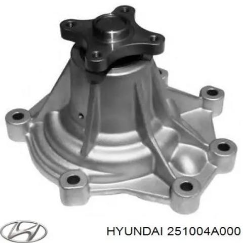 Помпа водяна, (насос) охолодження 251004A000 HYUNDAI