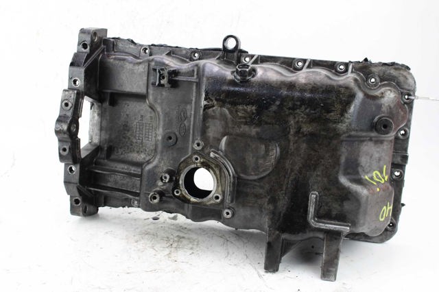 Піддон двигуна 215102A310 HYUNDAI