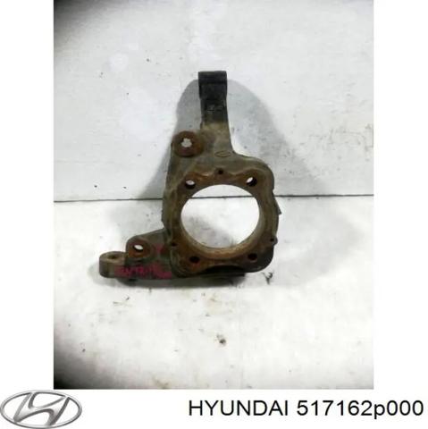 Цапфа передні праві 517162P000 HYUNDAI