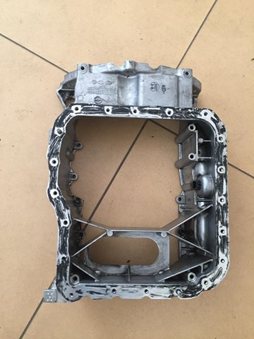 Піддон масляний картера двигуна, верхня частина 215102F004 HYUNDAI