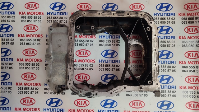 Піддон масляний картера двигуна, верхня частина 215102F004 HYUNDAI