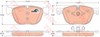 Колодки гальмівні дискові комплект GDB1726 TRW