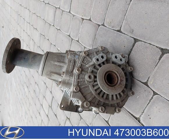 Коробка роздавальна в зборі Hyundai Santa Fe 3