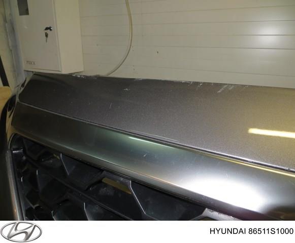 86375S1020 Hyundai/Kia 