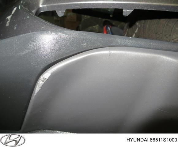 Купити 86577S1000 Hyundai/Kia Аеродинамічні обважування