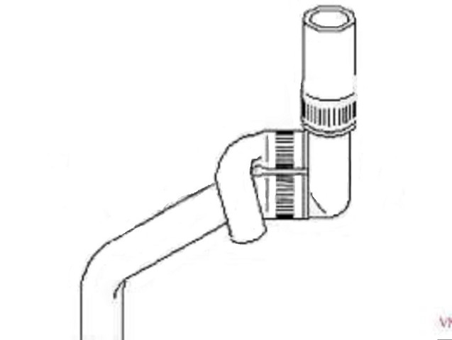  P0150 ACS